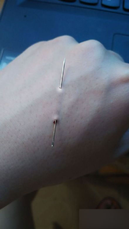 ps图片合成超逼真针扎进肉里的效果