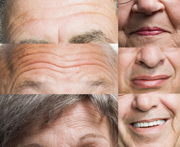 接下来的重灾区是法令纹和抬头纹