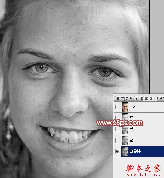 photoshop利用通道为满脸痘痘人物磨皮教程