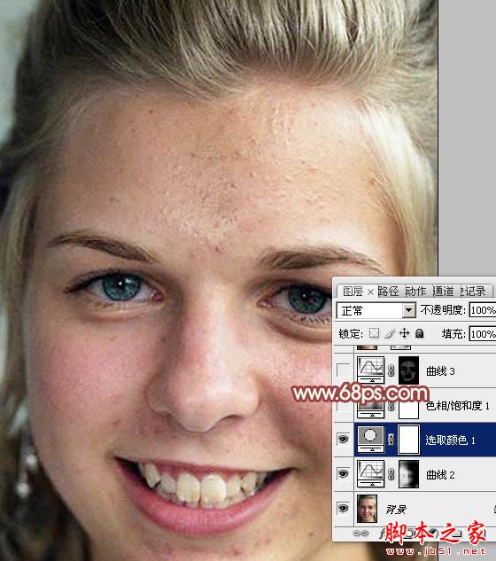 photoshop利用通道为满脸痘痘人物磨皮教程